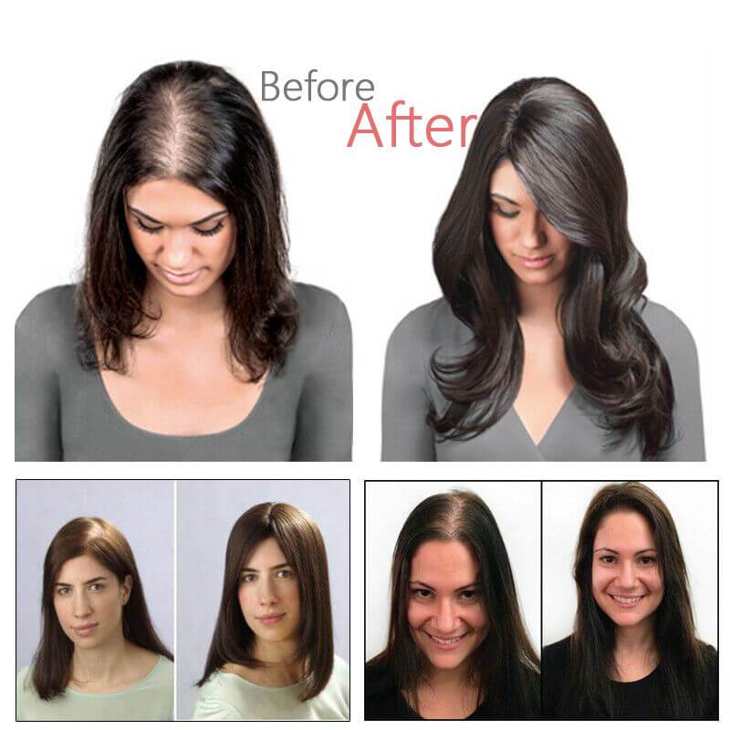 Women Toupee